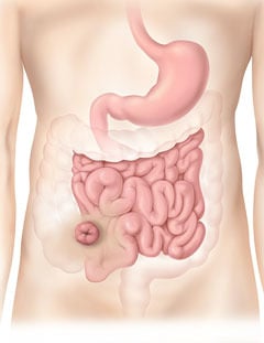 illustration of an abdomen