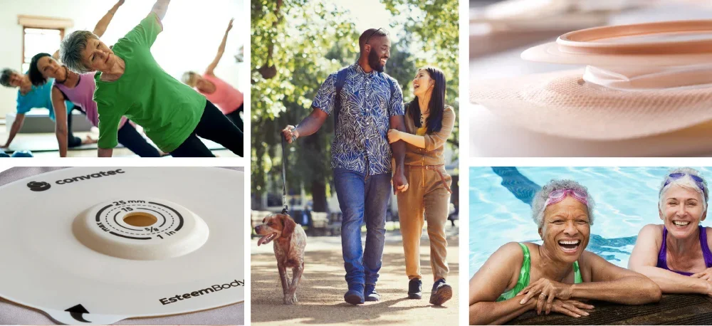 Scegliere il sistema per stomia adatto