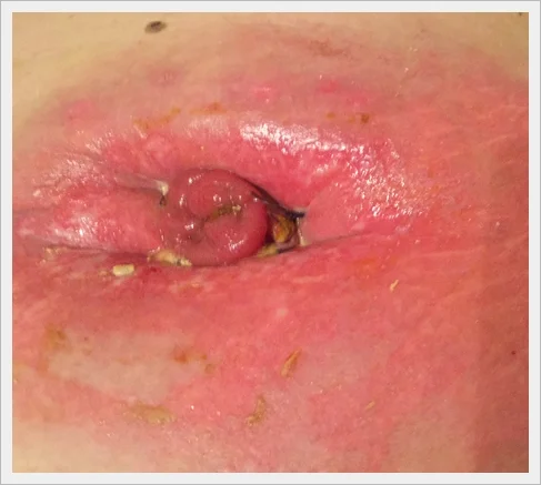 zbliżenie ust osoby