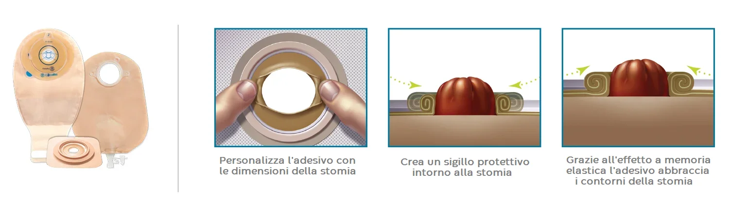 Stoma di forma irregolare - immagine del sito web
