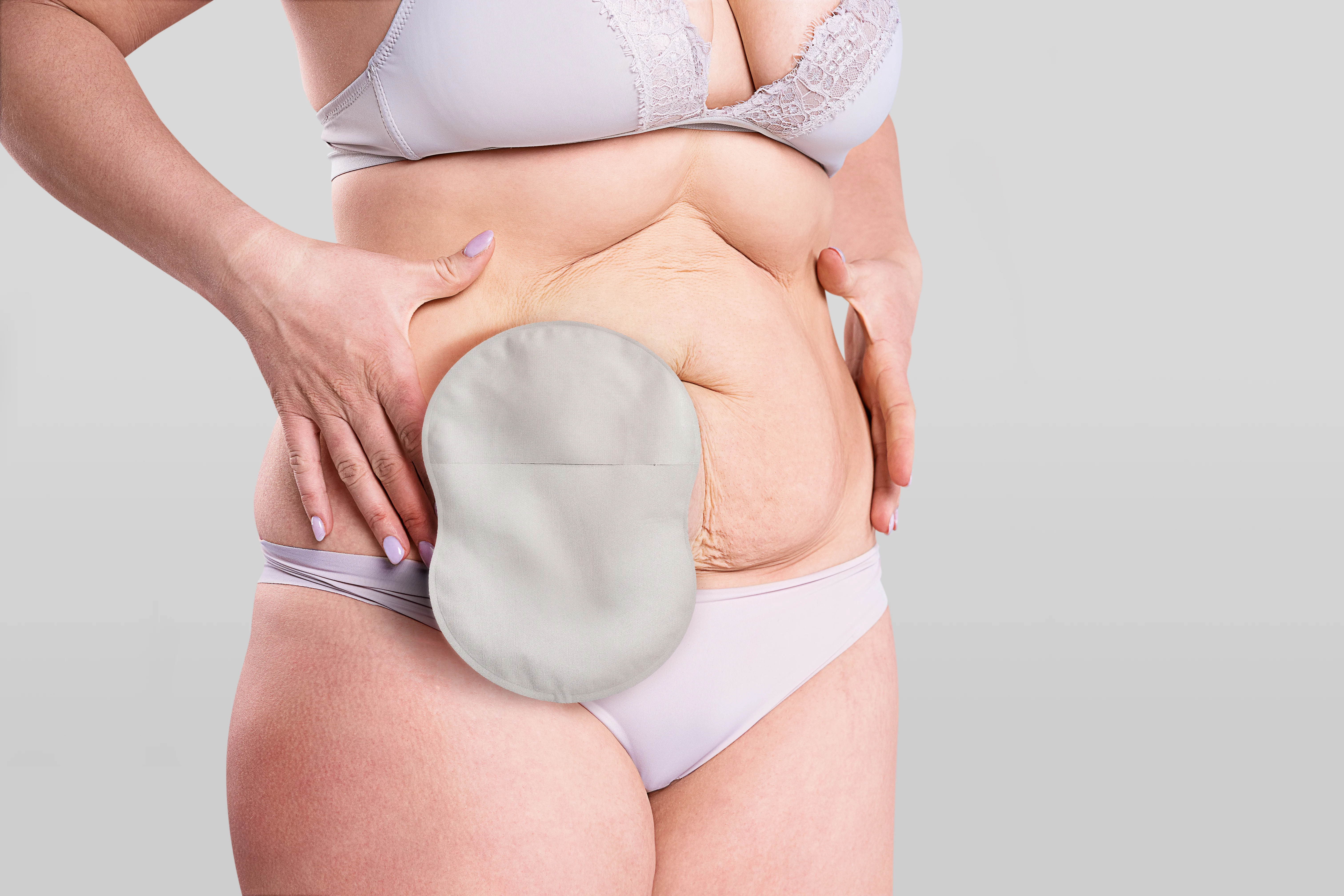 woman wearing an Esteem Body™ ostomy pouch standing
