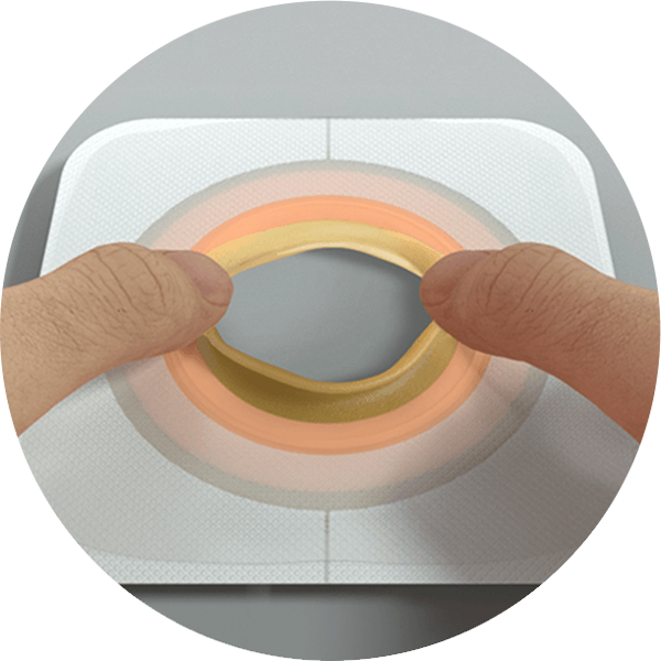 illustration of a skin barrier